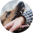 Animal Attacks & Dog Bites